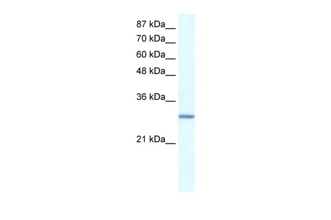 Antibody used in WB on Human Daudi at 0.2-1 ug/ml.