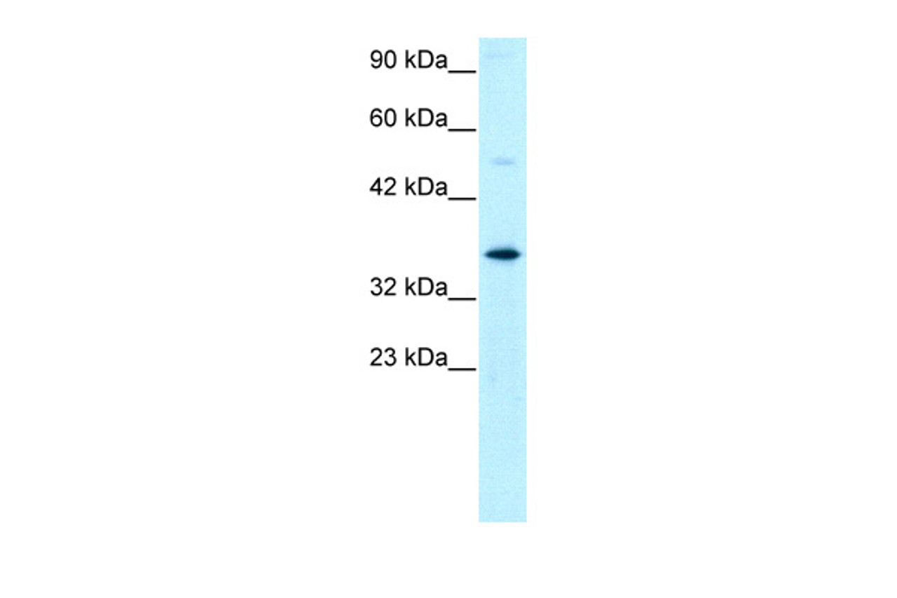 Antibody used in WB on Human Jurkat 0.2-1 ug/ml.