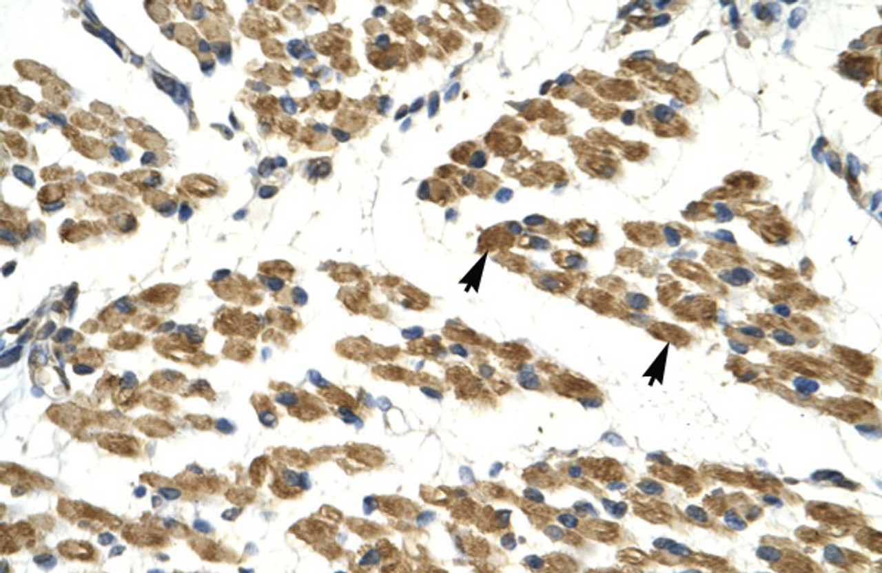 Antibody used in IHC on Human Muscle.