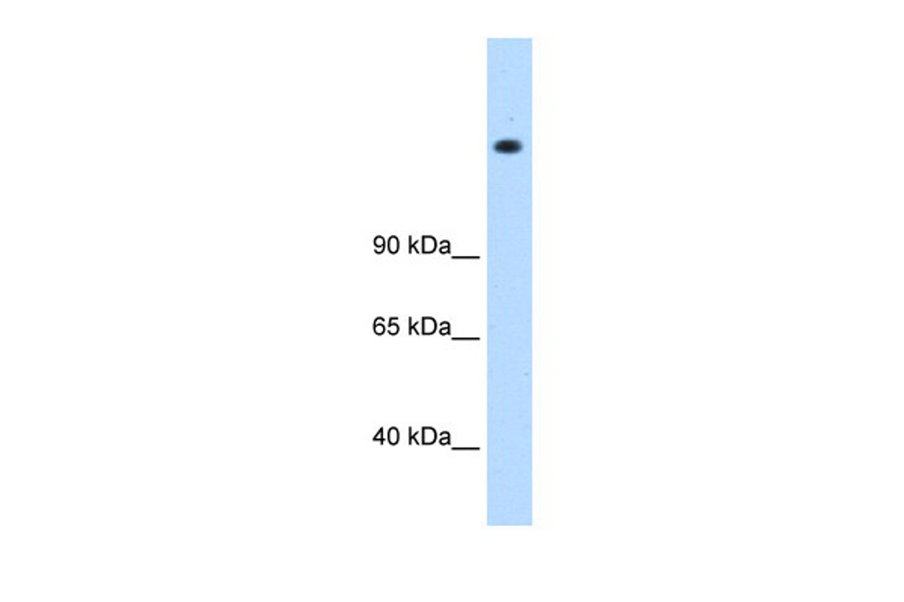 Antibody used in WB on Human 721_B cells at 0.2-1 ug/ml.