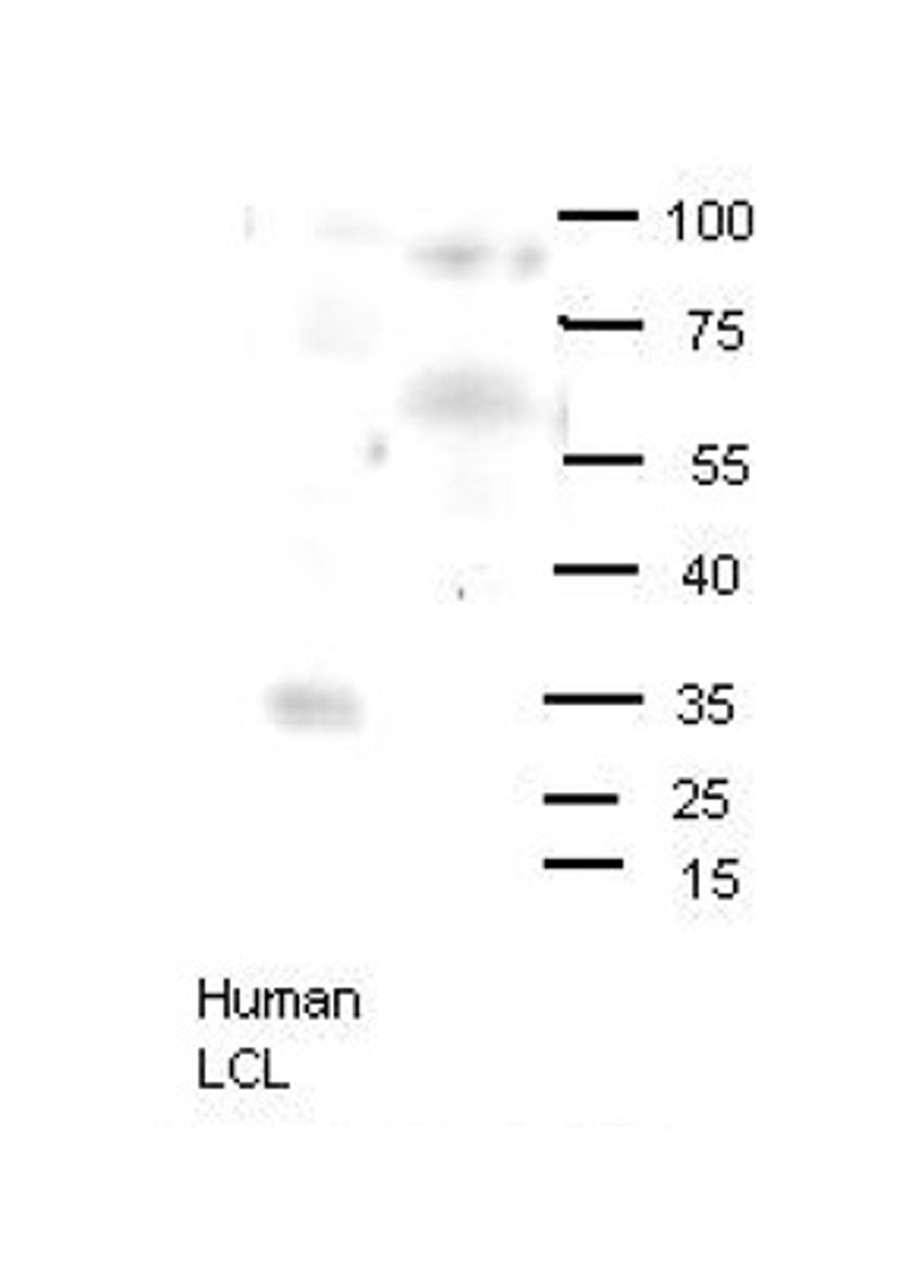 Antibody used in WB on human LCL and mouse brains at 1:1000.