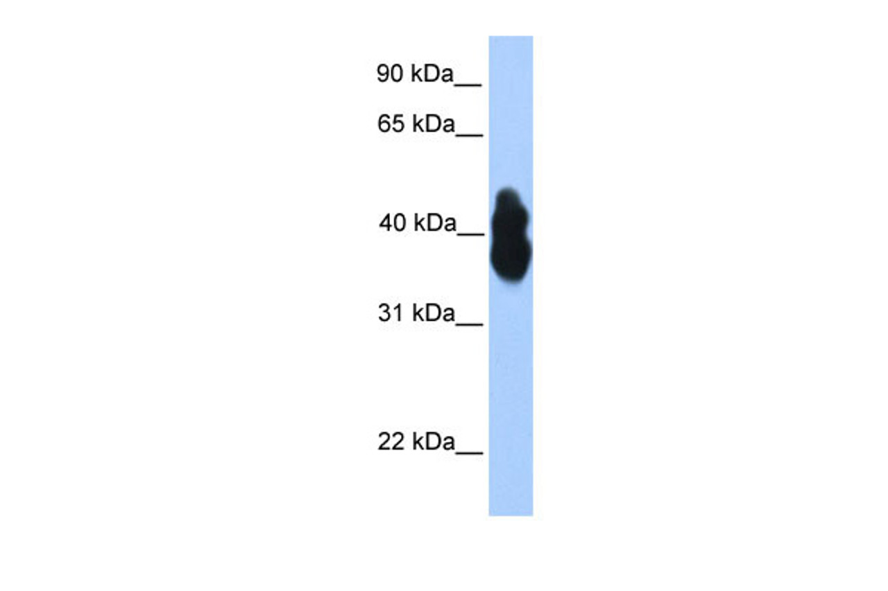 Antibody used in WB on Human 293T at 0.2-1 ug/ml.