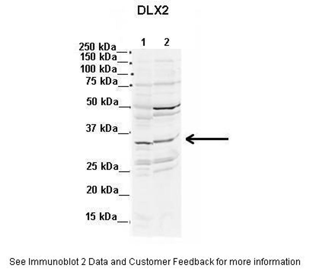 Antibody used in WB on Mouse, Rat 2 ug/ml (Lanes: 1. Mouse WT brain extract (80ug) 2. Rat brain extract (80ug) ) .