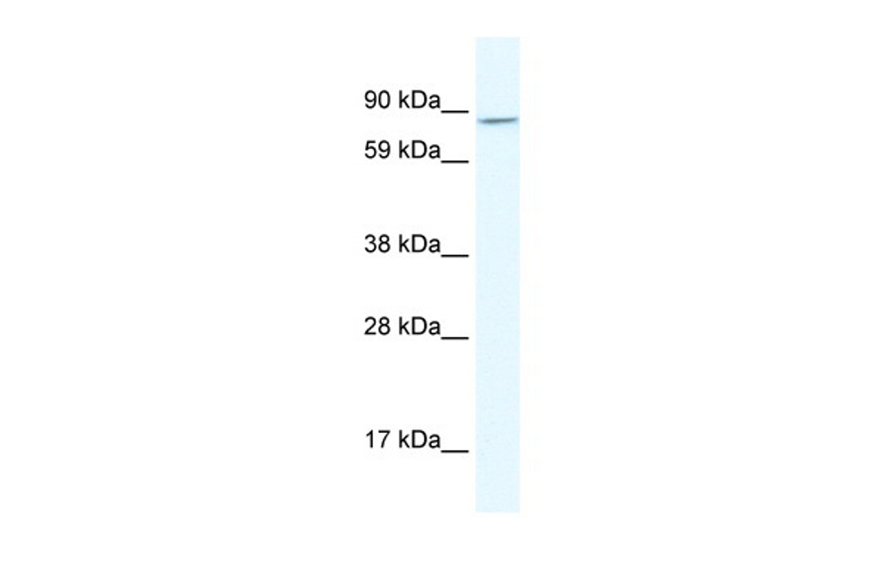 Antibody used in WB on Human Placenta at 2.5 ug/ml.