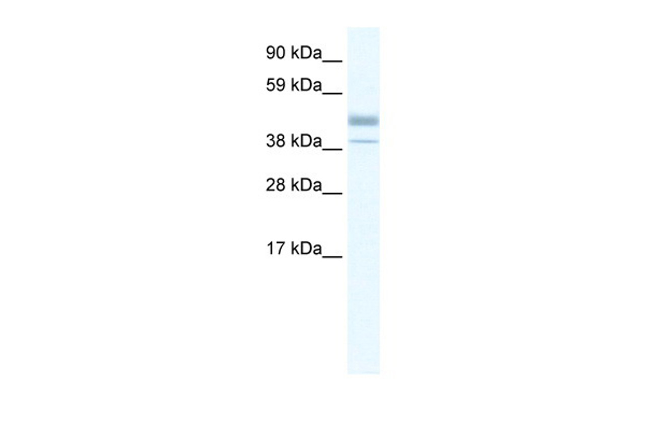 Antibody used in WB on Human kidney lysate at 0.2-1 ug/ml.