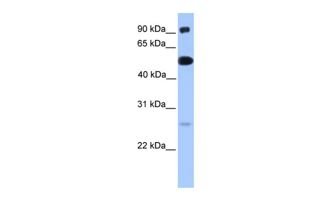 Antibody used in WB on Human Lung at 0.2-1 ug/ml.