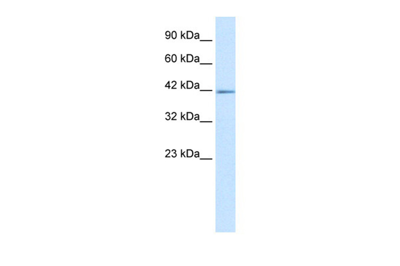 Antibody used in WB on Human HepG2 at 5.0 ug/ml.