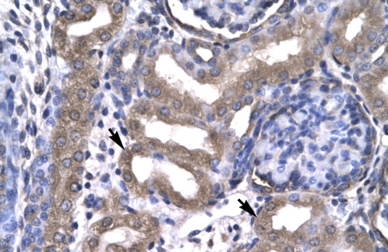 Antibody used in IHC on Human kidney lysate.