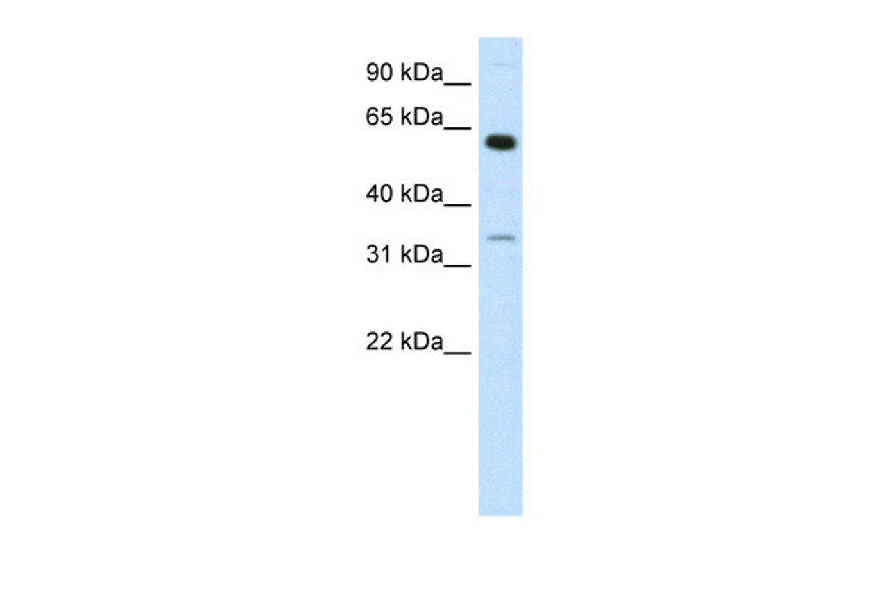 Antibody used in WB on Human Brain lysate at 1.25 ug/ml.