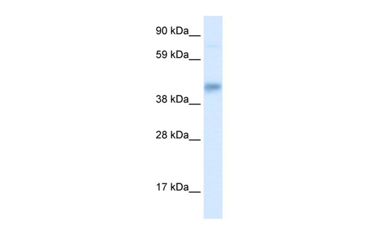 Antibody used in WB on Human Liver cell lysates at 0.2-1 ug/ml.