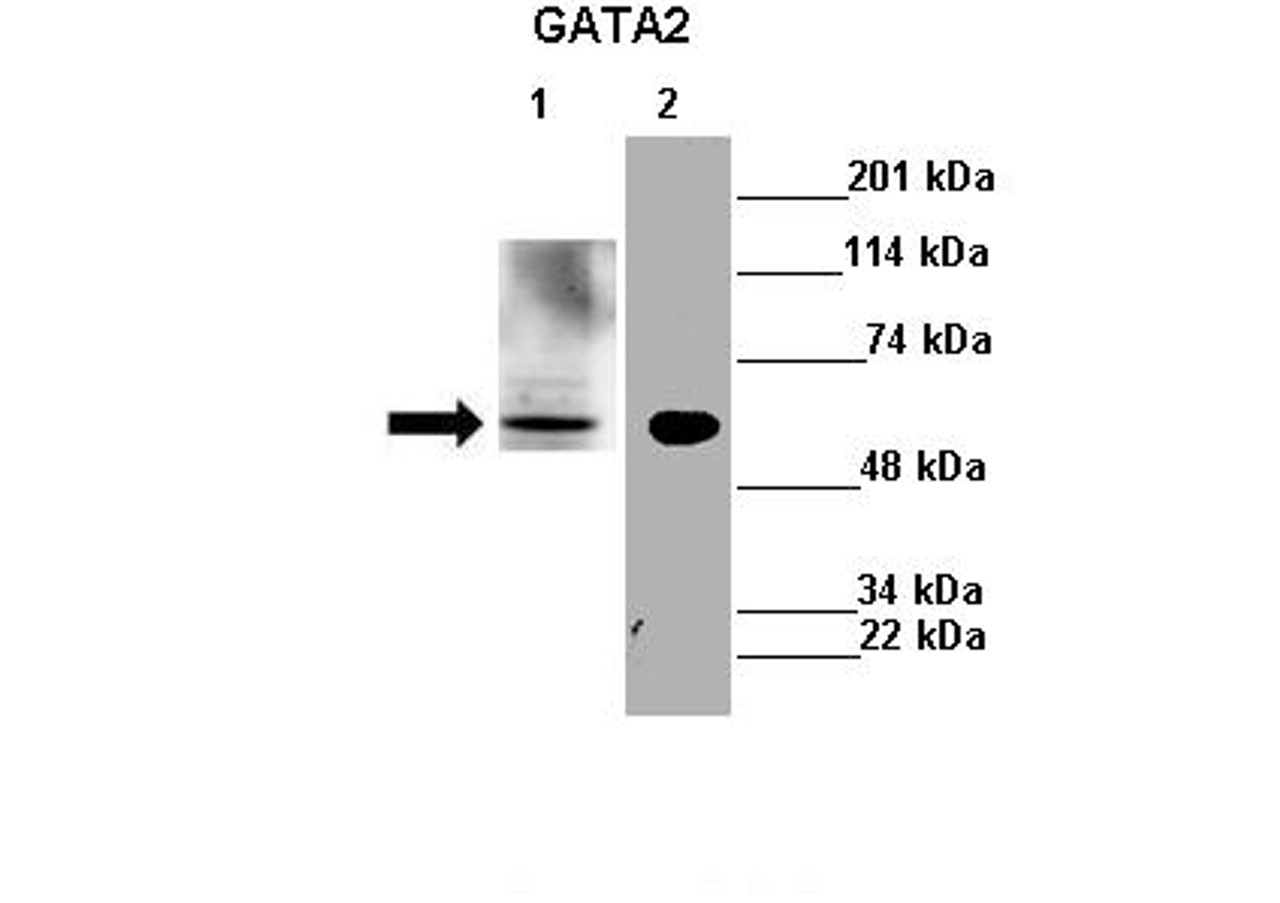 Antibody used in WB on Mouse liver, N2a at 1:500 (Lanes : Lane 1: 30ug mouse liver lysateLane 2: 30ug mouse N2a cell lysate) .