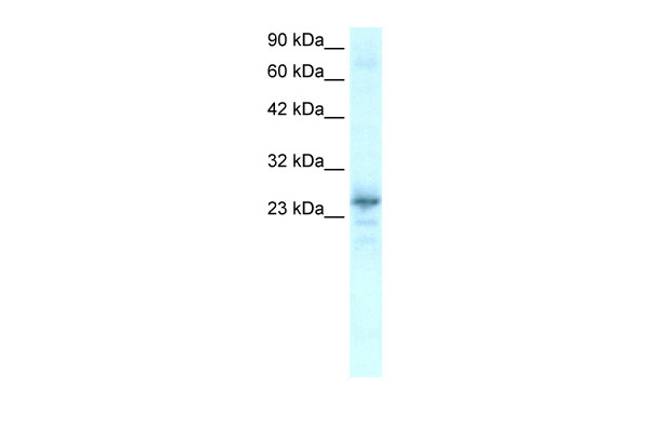 Antibody used in WB on Human Heart lysate at 0.2-1 ug/ml.
