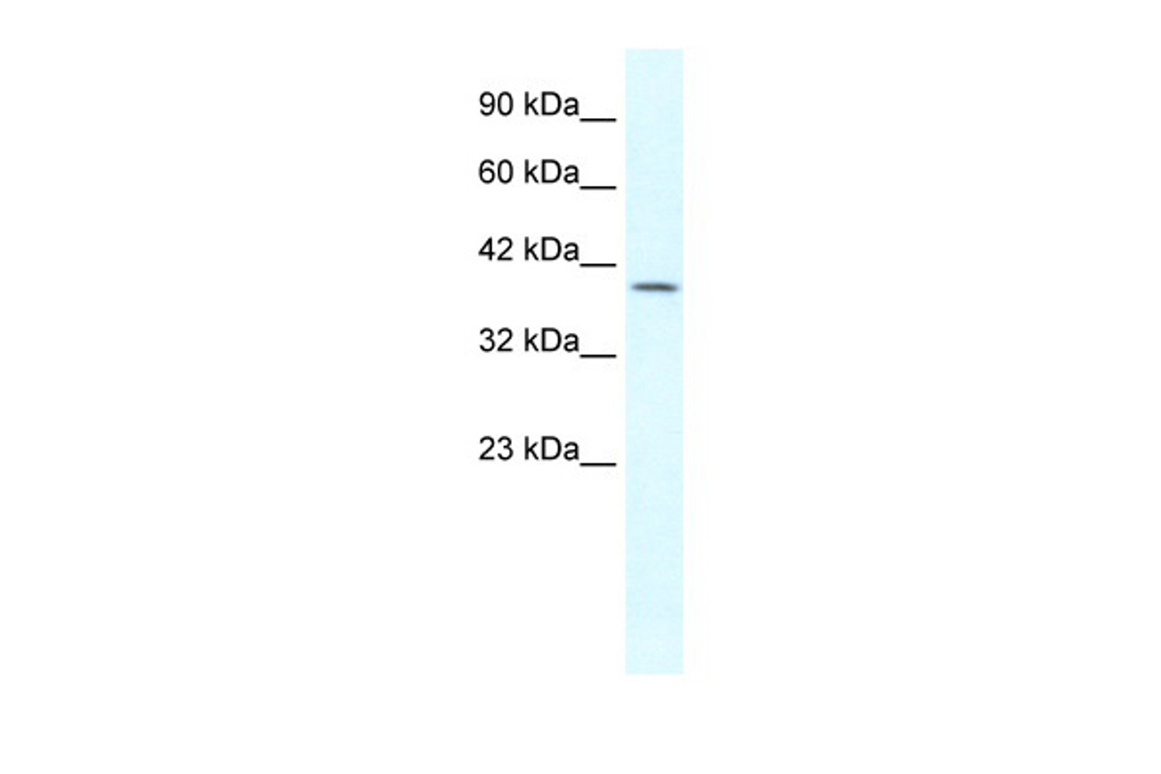 Antibody used in WB on Human Jurkat 1.25 ug/ml.