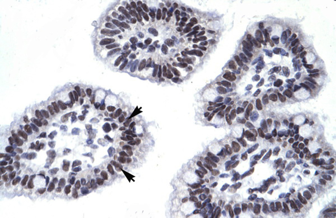 Antibody used in IHC on Human Intestine.