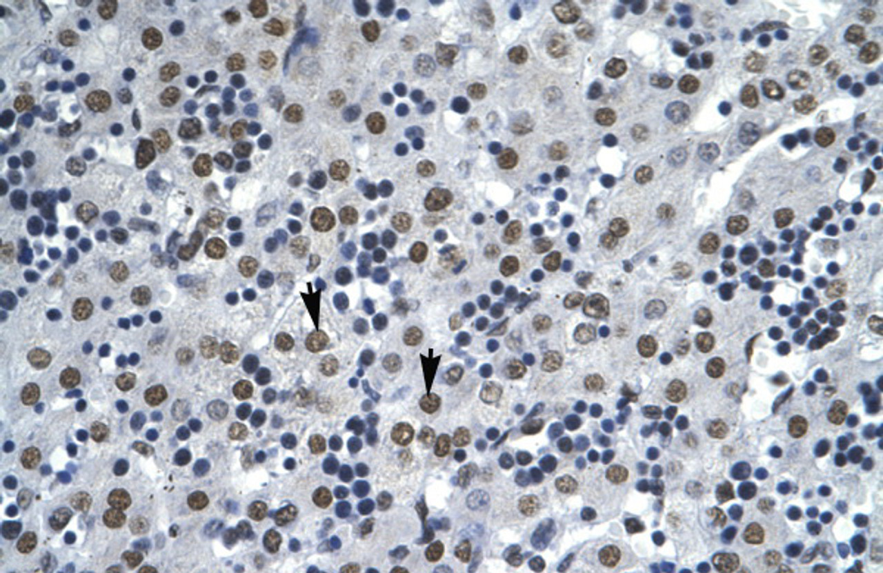 Antibody used in IHC on Human Liver cell lysates.