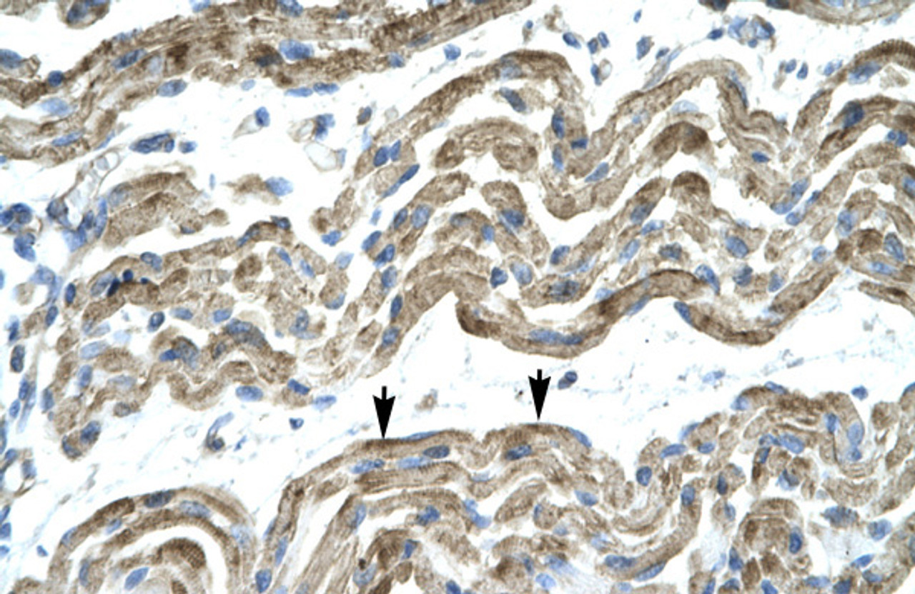 Antibody used in IHC on Human Muscle.