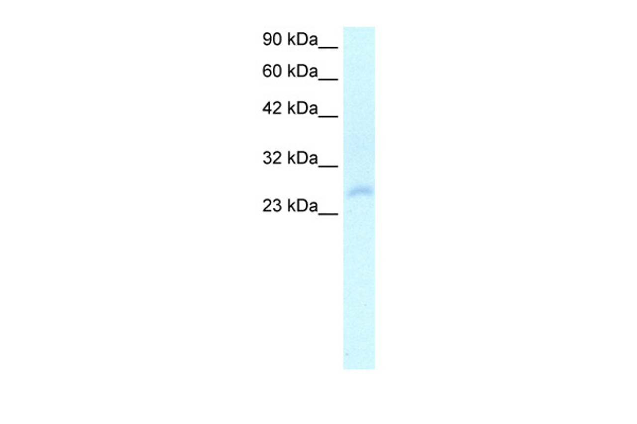 Antibody used in WB on Human Liver cell lysates at 2.0 ug/ml.