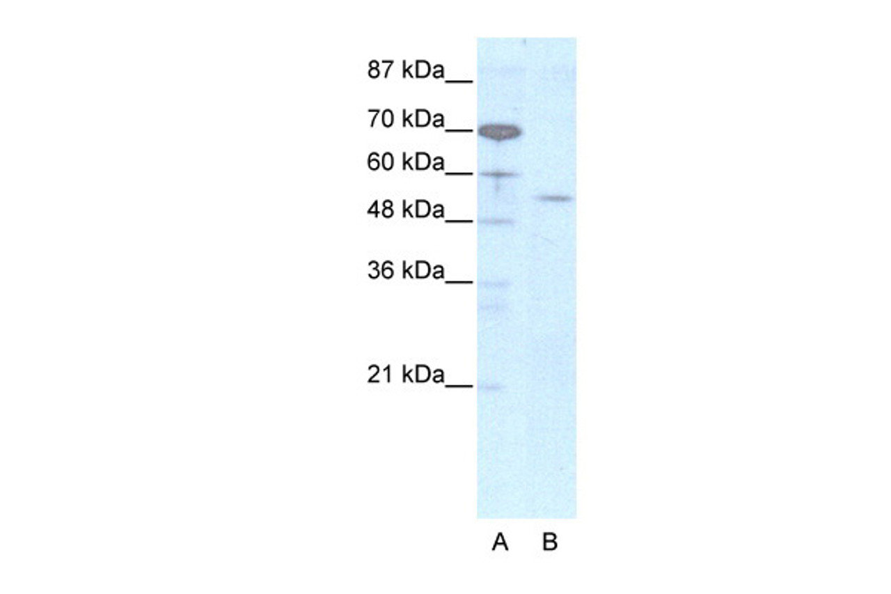 Antibody used in WB on Human HepG2 at 2.5 ug/ml.