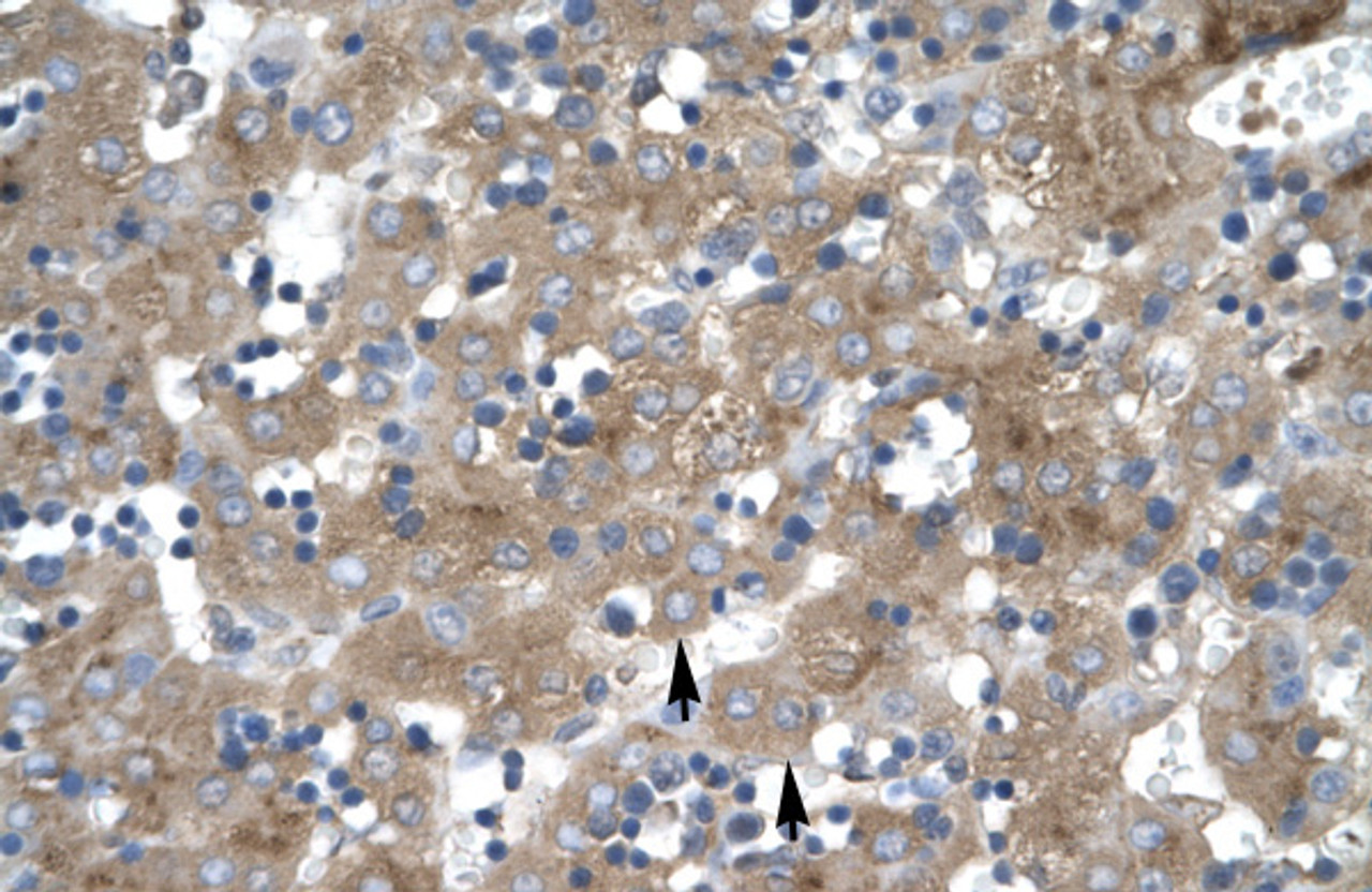 Antibody used in IHC on Human Liver cell lysates.