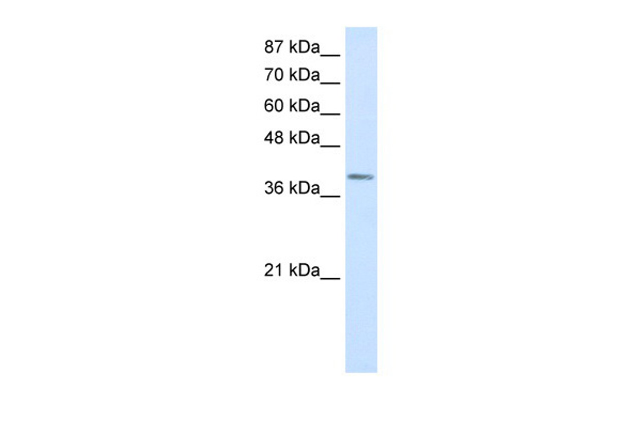 Antibody used in WB on Human Jurkat 0.3125 ug/ml.