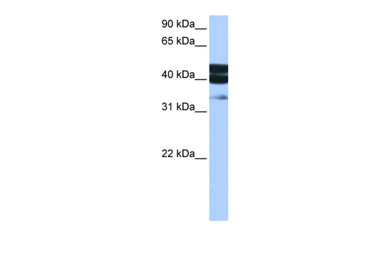 Antibody used in WB on Human MCF-7 at 0.2-1 ug/ml.