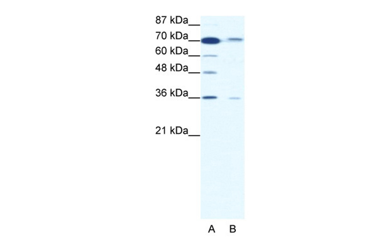 Antibody used in WB on Human HepG2 at 1.25 ug/ml.