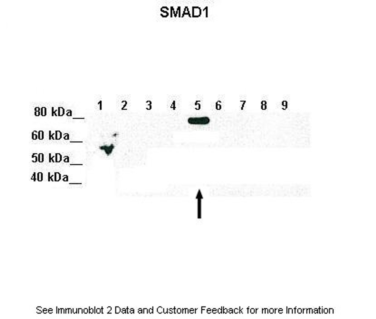 Antibody used in WB on r-SMAD5 at: 1:1000 (Lane 1: 5ug of transfected 293T lysate (SMAD1) , Lane 2: 5ug of transfected 293T lysate (SMAD2) , Lane 3: 5ug of transfected 293T lysate (SMAD3) , Lane 4: 5ug of transfected 293T lysate (SMAD4) , Lane 5: 5ug of transfected 293T lysate (SMAD5) , Lane 6: 5ug of transfected 293T lysate (SMAD6) , Lane 7: 5ug of transfected 293T lysate (SMAD7) , Lane 8: 5ug of transfected 293T lysate (SMAD8) , Lane 9: 5ug of transfected 293T lysate (GFP) ) .