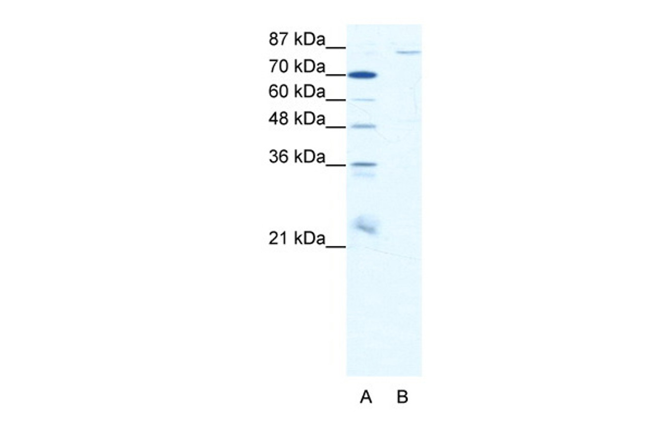 Antibody used in WB on Human HepG2 at 0.625 ug/ml.