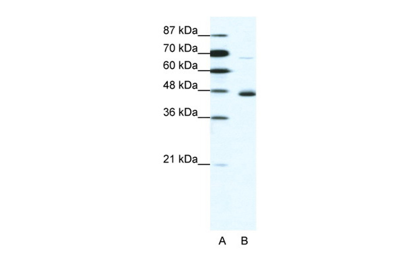 Antibody used in WB on Human Jurkat 1.25 ug/ml.