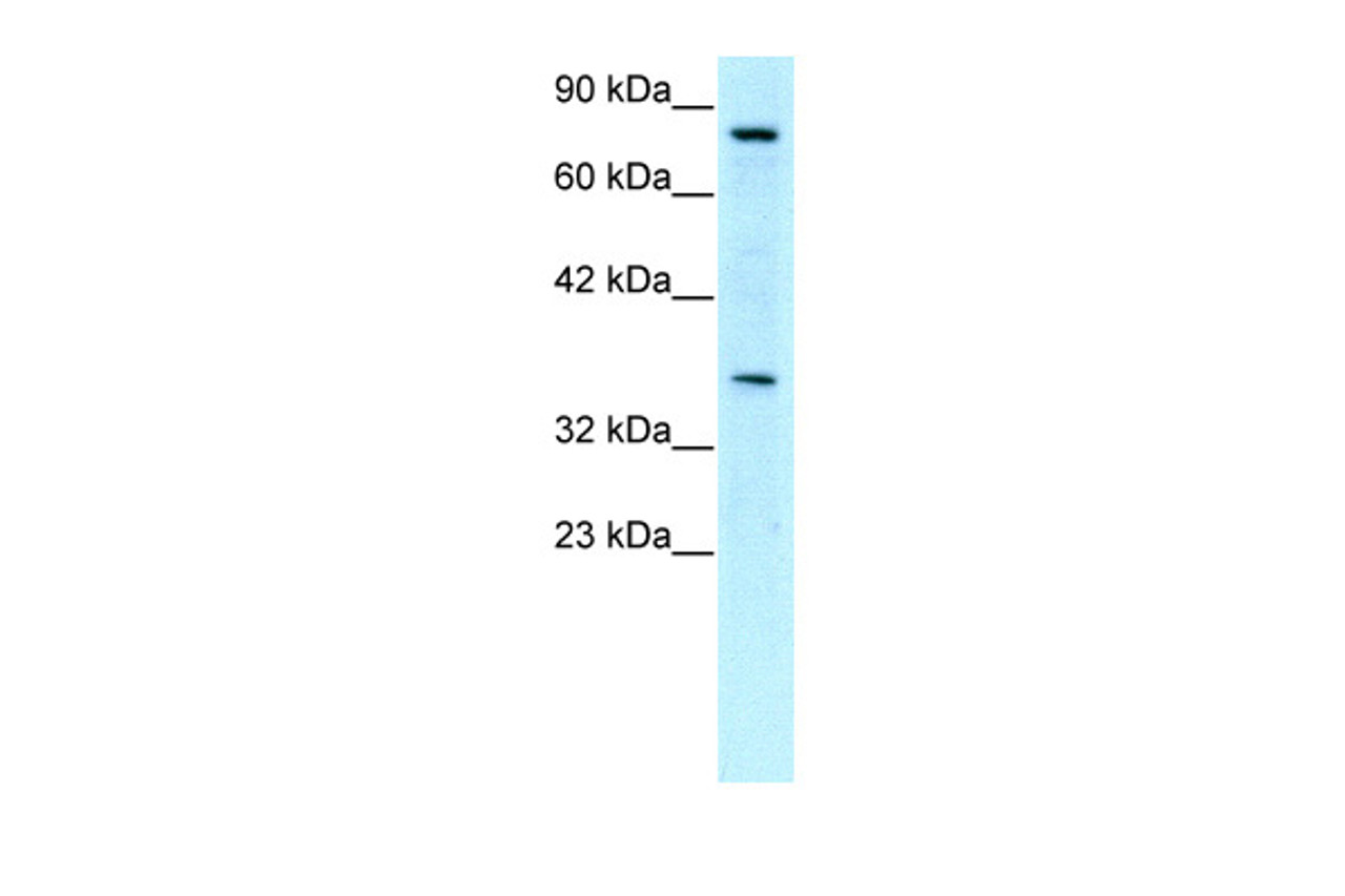 Antibody used in WB on Human Jurkat 0.2-1 ug/ml.