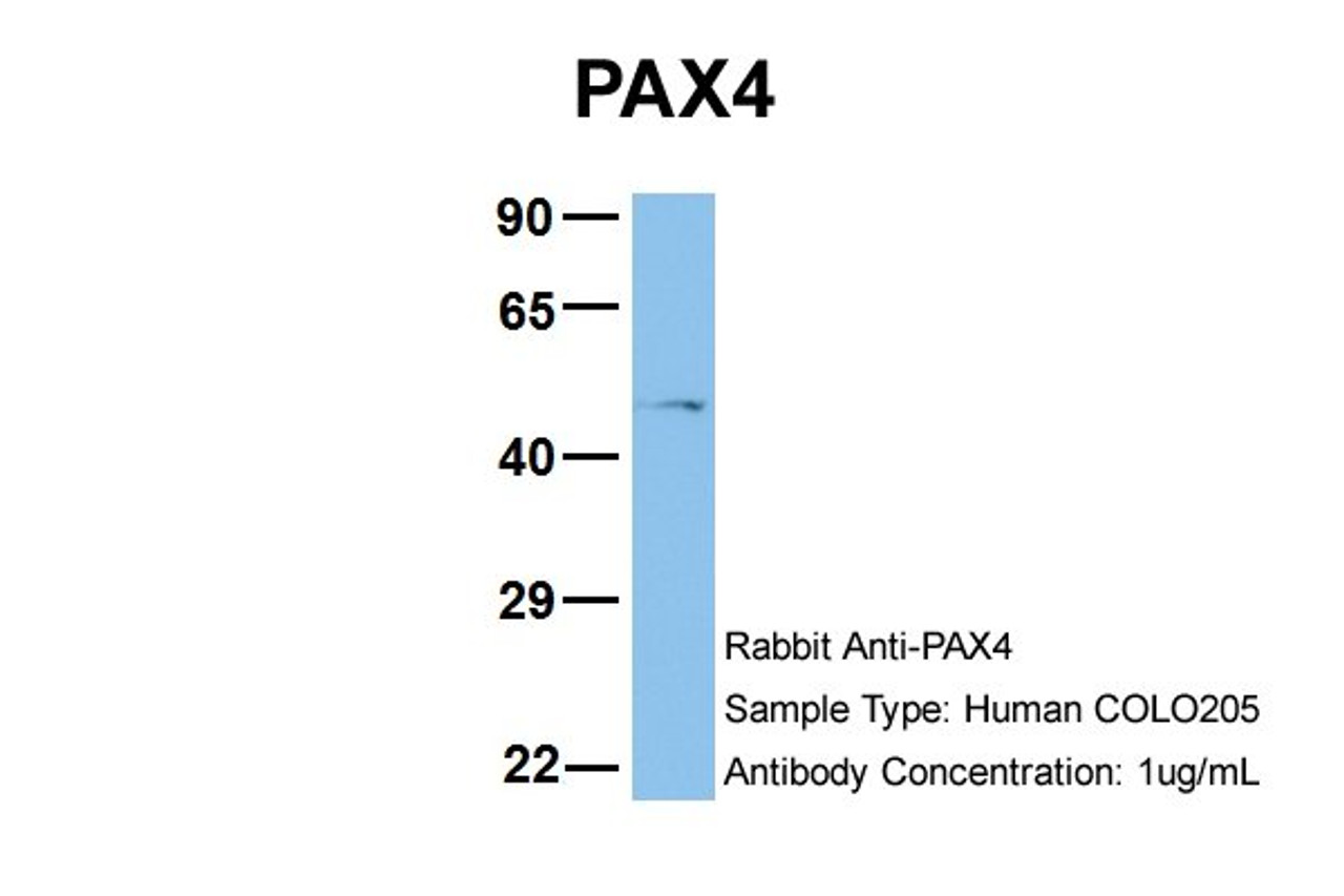 Antibody used in WB on Human COLO205 at 1 ug/ml.