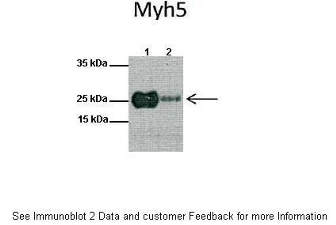 Antibody used in WB on Mouse skeletal at: 1:1000 (Lanes: 1: Mouse skeletal muscle lysate, 2: Mouse skeletal muscle lysate) .