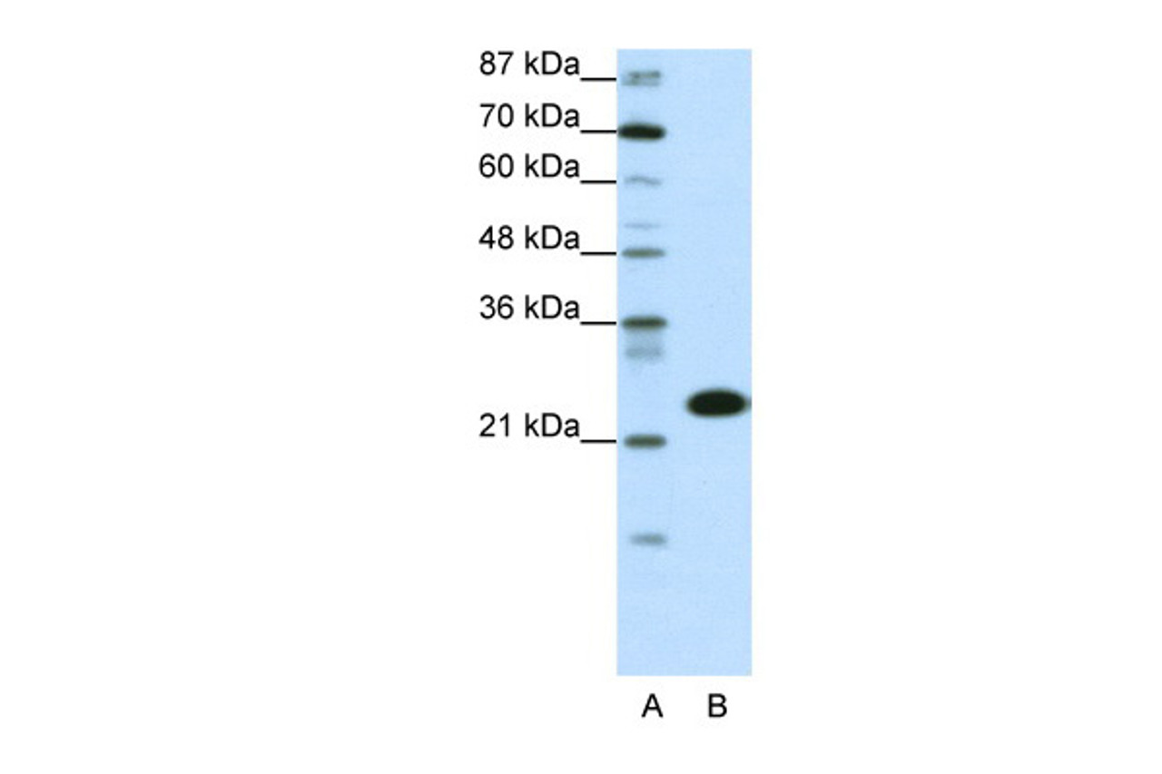 Antibody used in WB on Transfected 293T at 0.2-1 ug/ml.