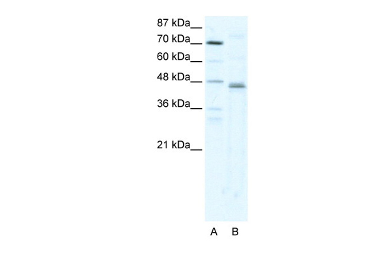 Antibody used in WB on Human HepG2 at 2.5 ug/ml.