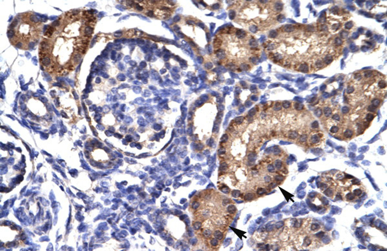 Antibody used in IHC on Human kidney.