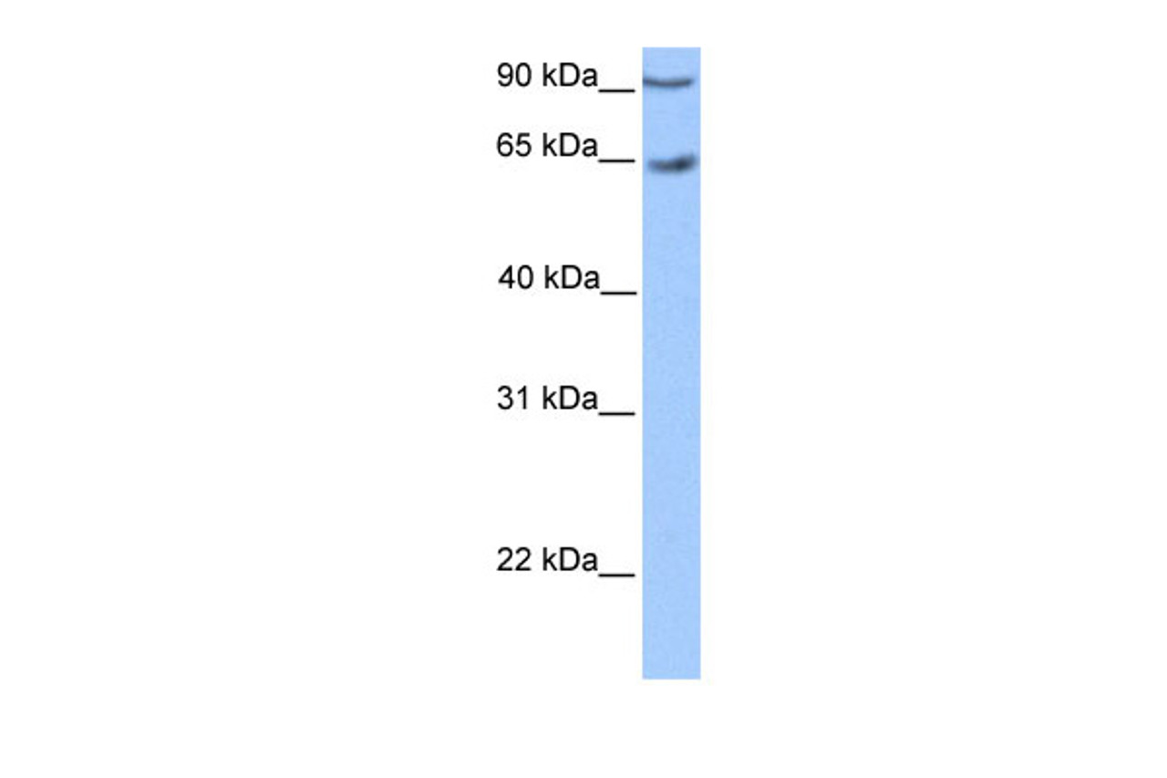 Antibody used in WB on Transfected 293T at 0.2-1 ug/ml.