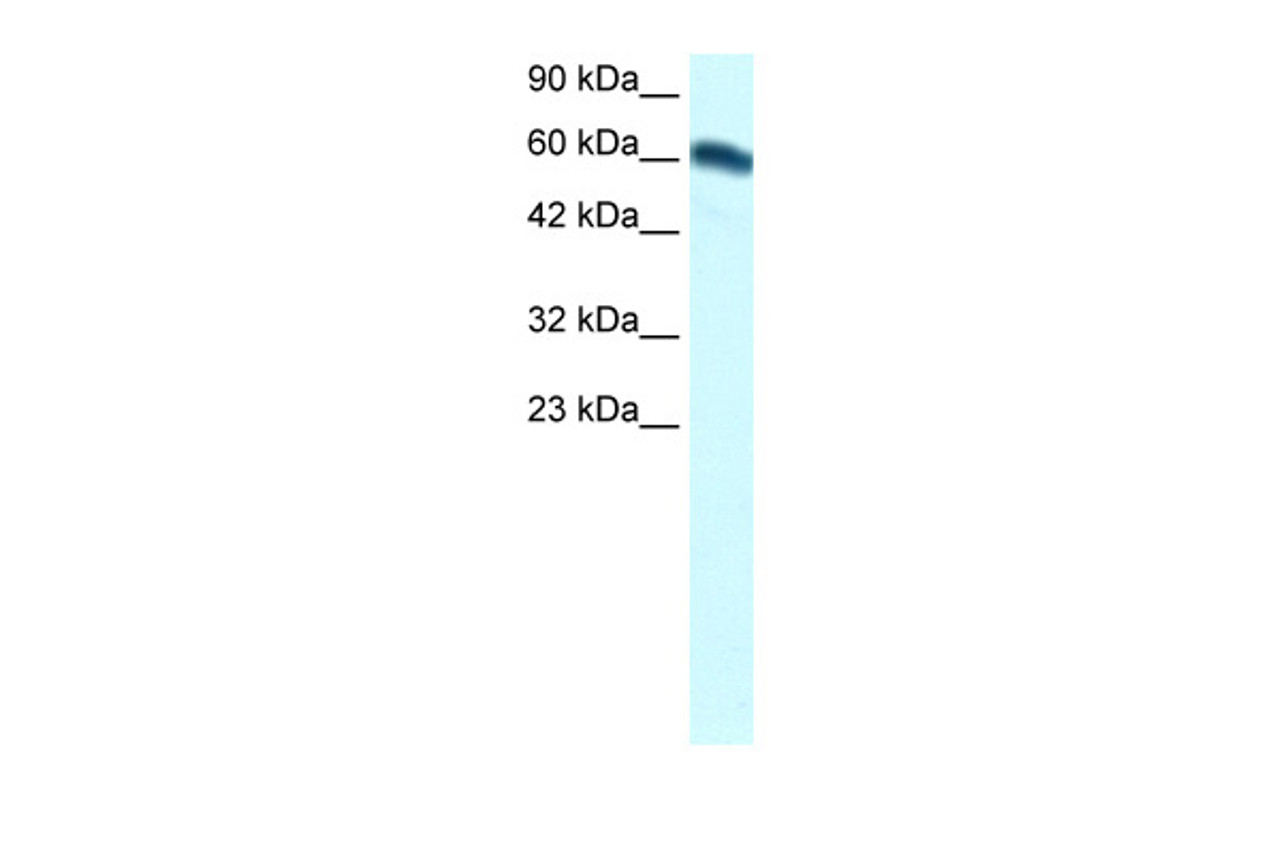 Antibody used in WB on Human kidney at 1.25 ug/ml.