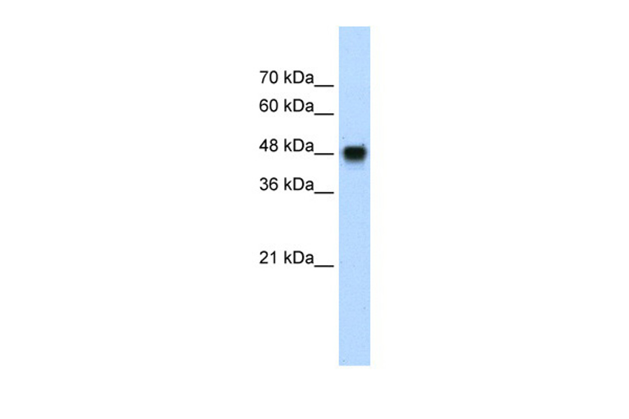 Antibody used in WB on Transfected 293T at 1.25 ug/ml.