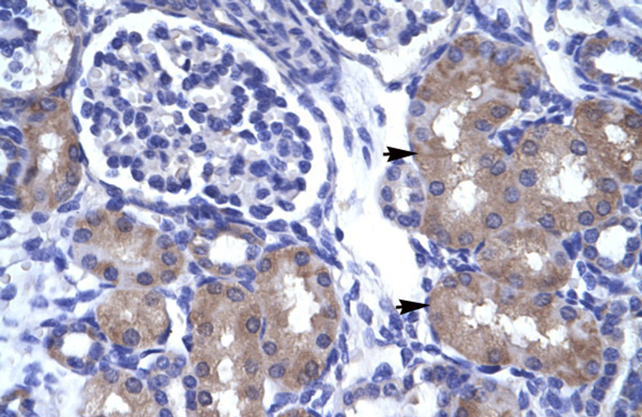 Antibody used in IHC on Human kidney.