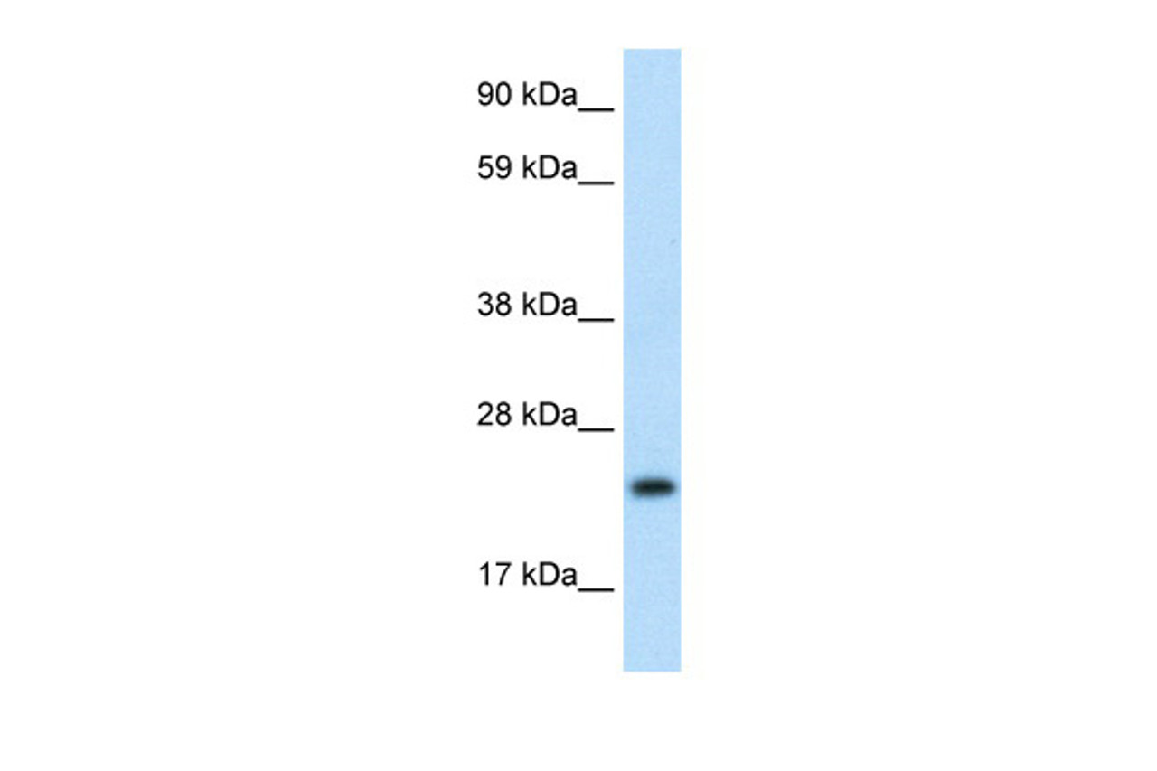 Antibody used in WB on Human Thymus at 1.25 ug/ml.