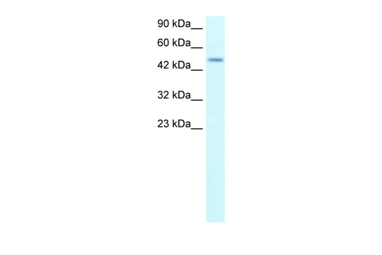 Antibody used in WB on Human Jurkat 0.2-1 ug/ml.