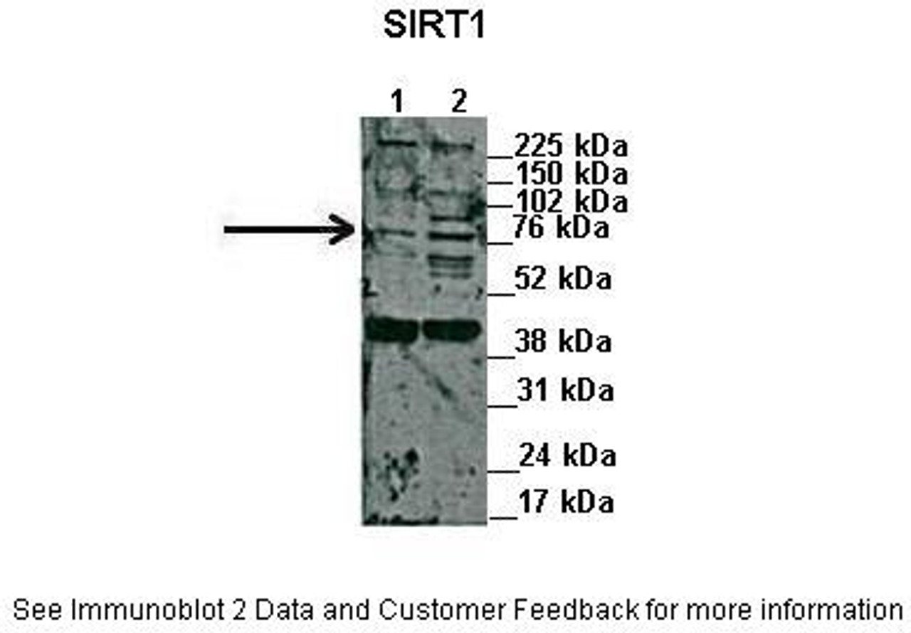 Antibody used in WB on Human capan1, HPAF at: 1:1000 (Lane 1. 45ug capan1 cell lysate Lane 2. 45 ug HPAF cell lysate) .