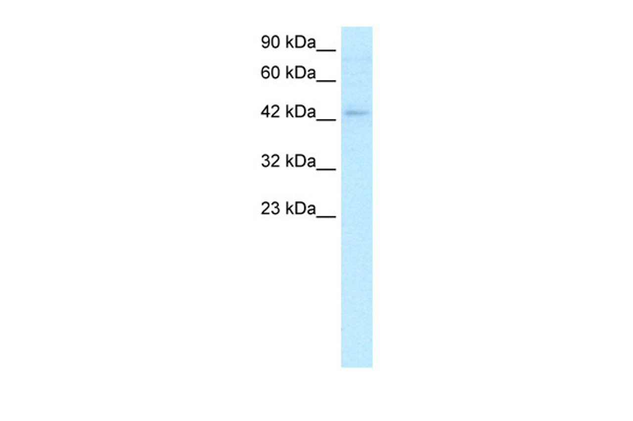 Antibody used in WB on Human Jurkat cells at 2.0 ug/ml.