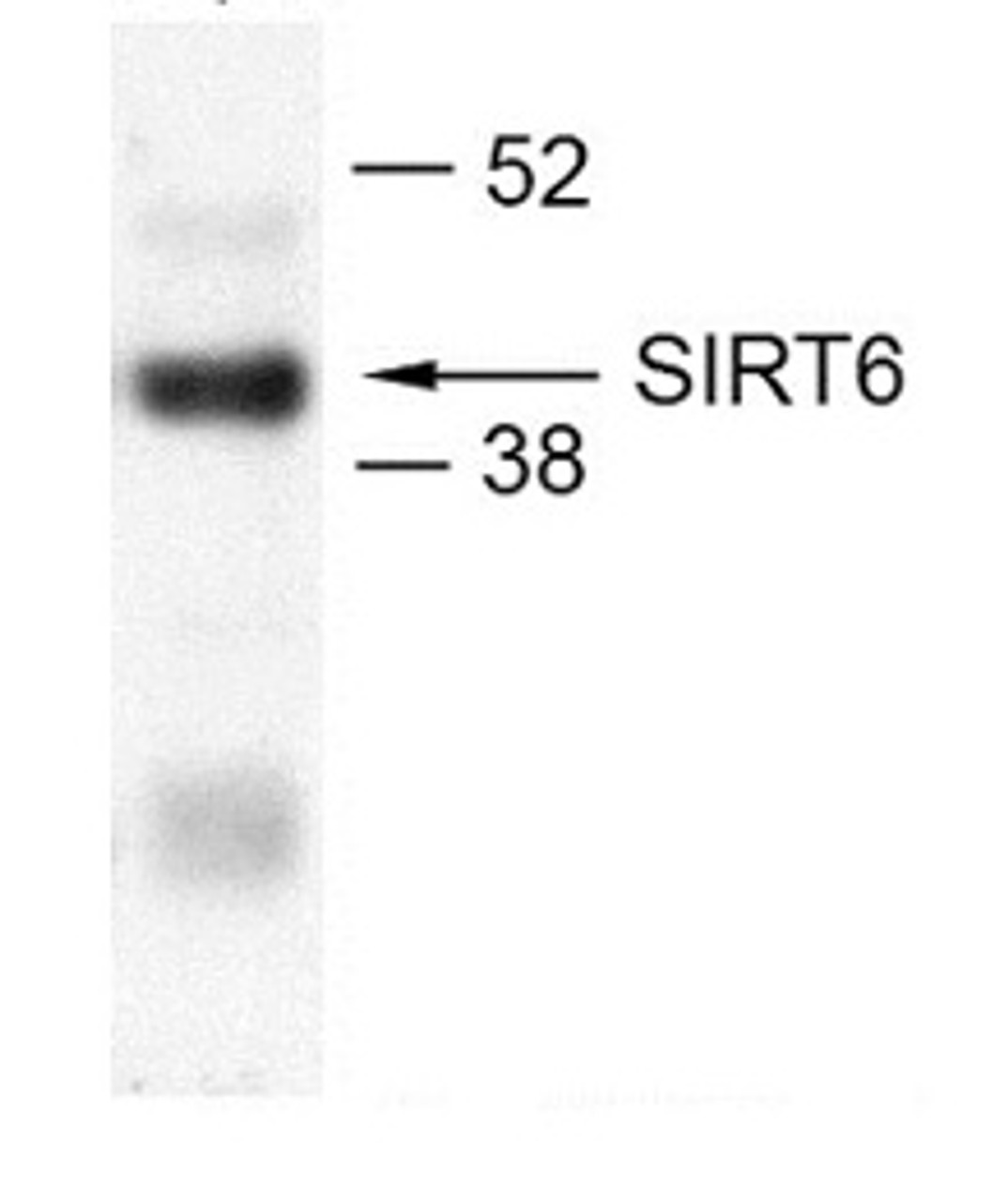 Antibody used in WB on Human U2OS.