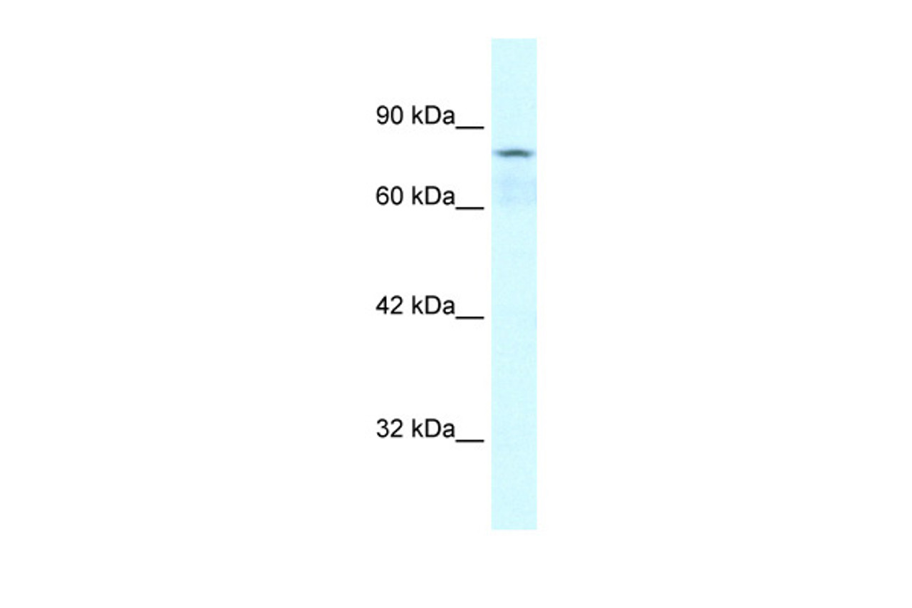 Antibody used in WB on Human Jurkat 0.2-1 ug/ml.