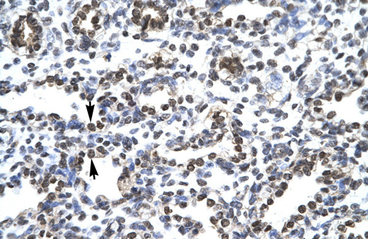 Antibody used in IHC on Human Lung.