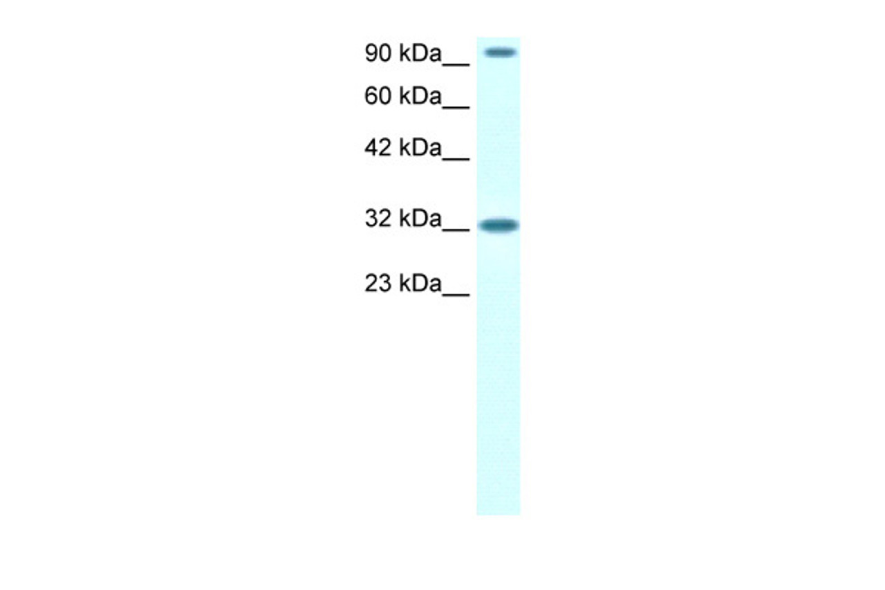 Antibody used in WB on Human Jurkat 1.25 ug/ml.