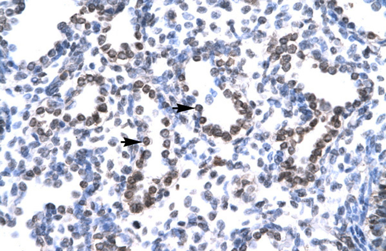 Antibody used in IHC on Human Lung at 4.0-8.0 ug/ml.