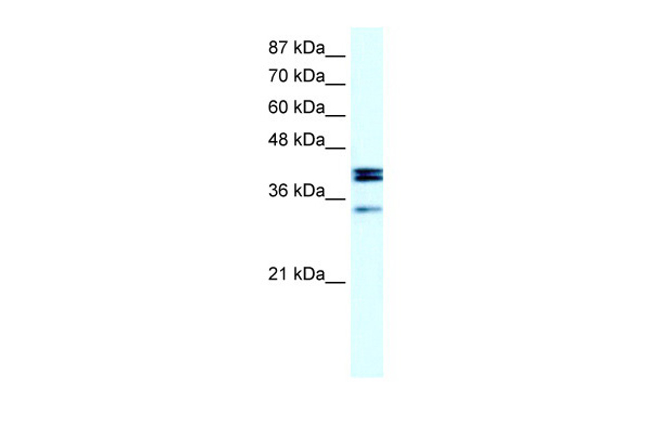 Antibody used in WB on Human Daudi at 20 ug/ml.