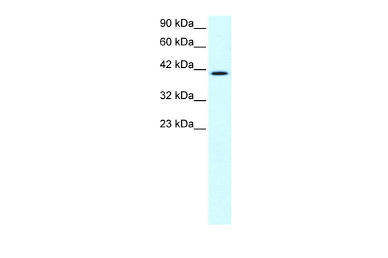 Antibody used in WB on Human Daudi at 1.0-2.0 ug/ml.